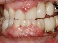 Konig Center for Cosmetic & Comprehensive Dentistry smile photos